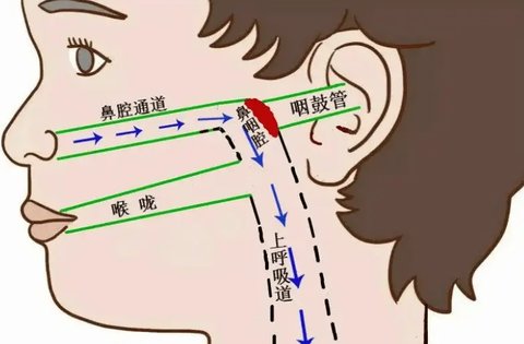 咽鼓管堵塞怎么疏通？咽鼓管堵塞自愈方法