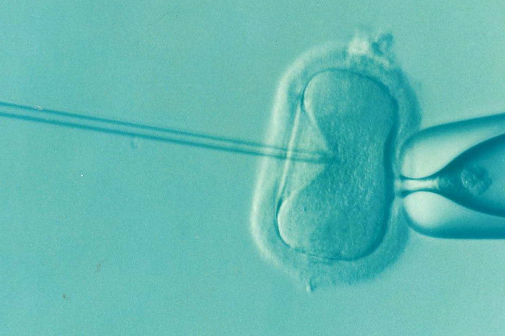 梅毒可以做试管婴儿吗？辅助生殖技术的可行性分析