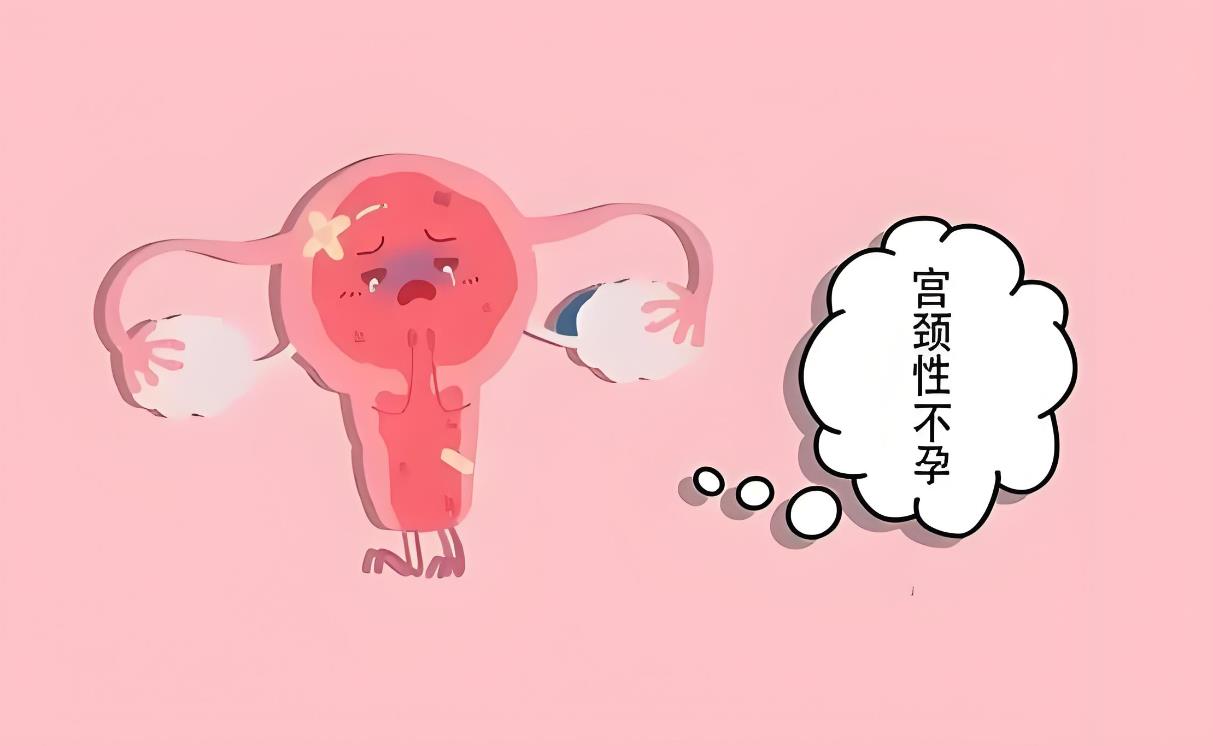 宫腔性不孕